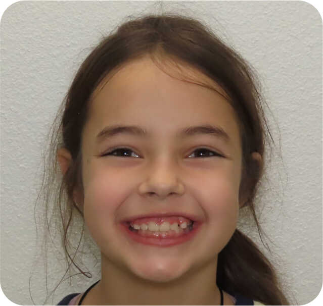 early-asymmetry gallery